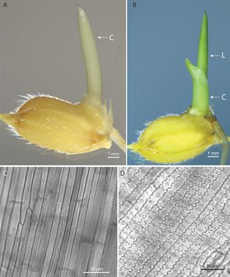 Frontiers | A Rapid And Highly Efficient Method For Transient Gene ...